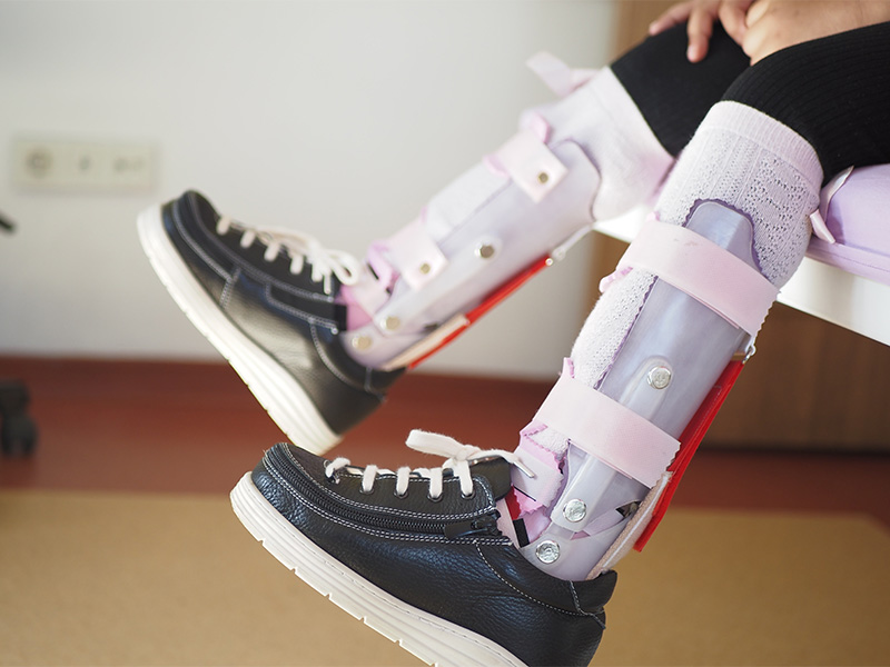 Kind mit Beinorthesen sitzt, medizinische Versorgungsarbeit sichtbar – individuelle Orthopädietechnik in Uelzen unterstützt Mobilität und Alltag.