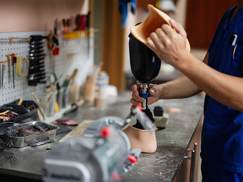 Techniker passt in einer Werkstatt eine moderne Prothese an – professionelle Orthopädietechnik in Uelzen für Mobilität und Lebensqualität.